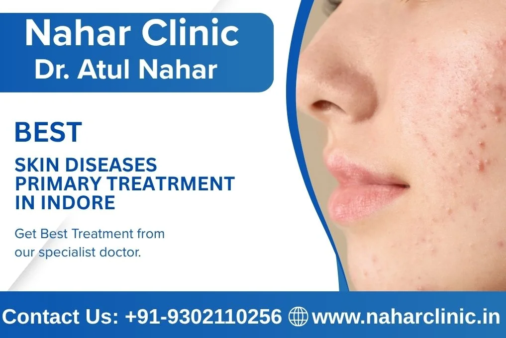 Skin Diseases Primary Treatrment In Indore