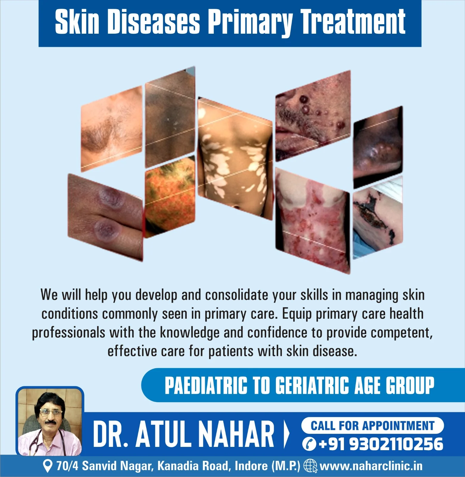 Skin Diseases Treatment in Indore